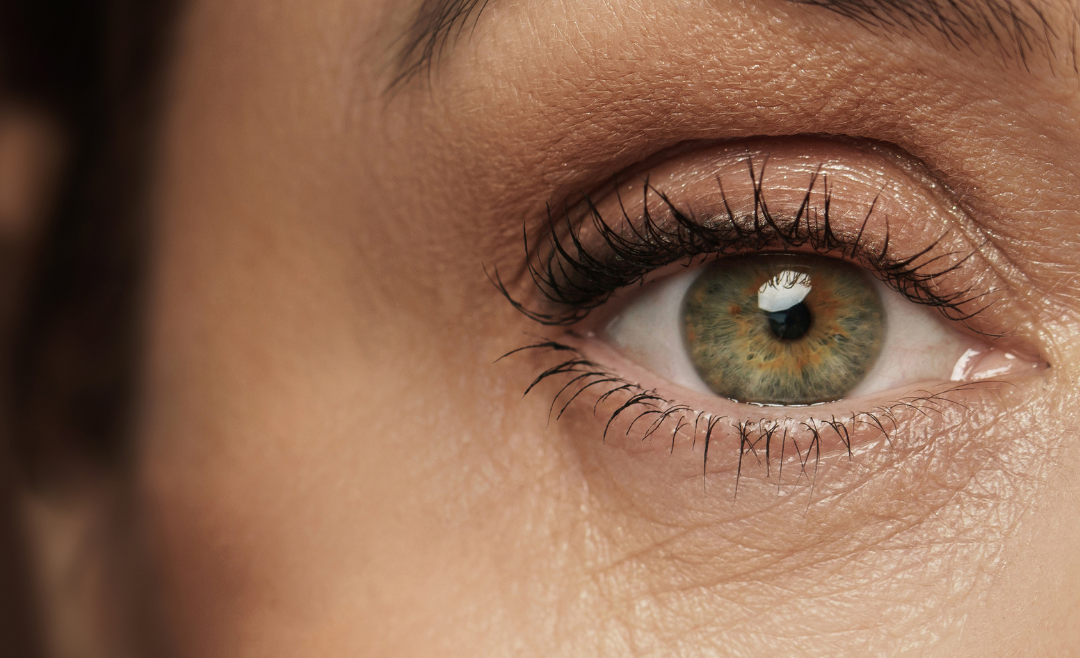 Dermal Filler